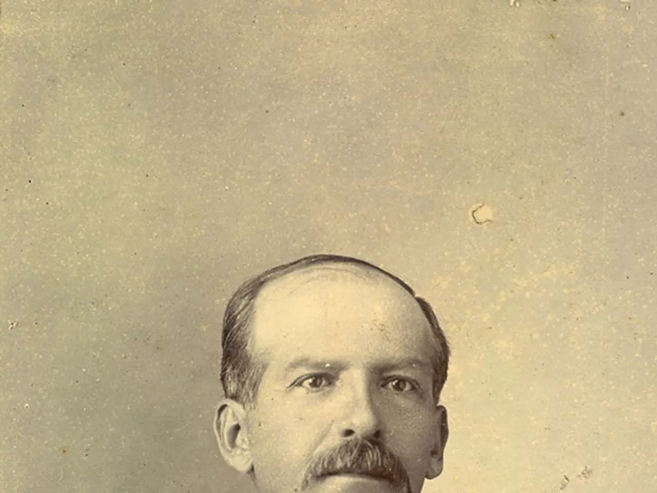 Contributions to insurance plans result in reduced pension benefits starting in July